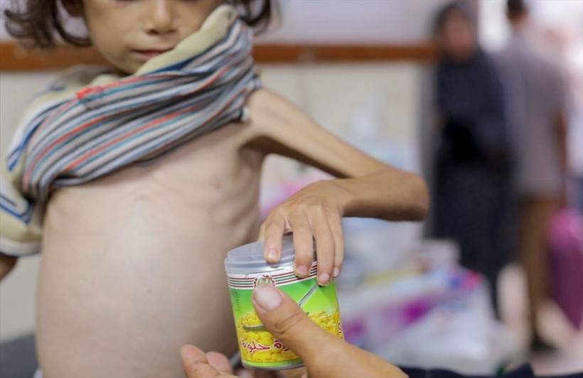 Gazze'de çocuklar açlık nedeniyle ölümle boğuşuyor - Resim: 13