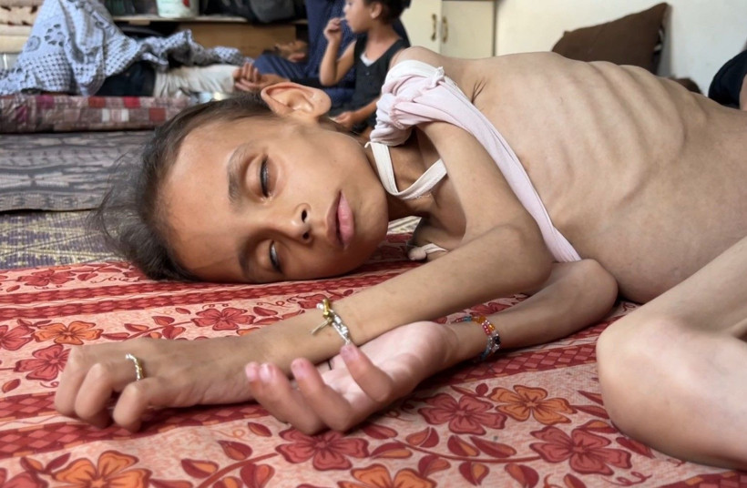 Gazze'de açlıkla mücadele: 9 yaşındaki Meryem 10 kiloya düştü - Resim: 3