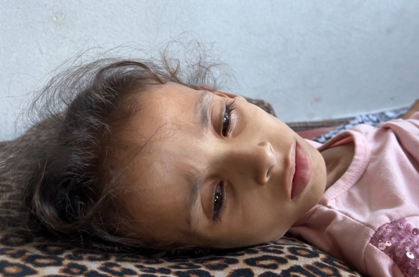Gazze'de açlıkla mücadele: 9 yaşındaki Meryem 10 kiloya düştü - Resim: 6