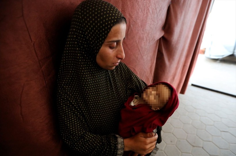 Gazze'de Selam Ebu Vadi açlıktan öldü - Resim: 21