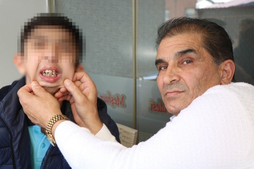 17 yaşındaki Yaşar Hüseyin'in alt çenesi yok, dişleri üst damağında! Aile, özel mamayla beslenen çocukları için çare arıyor - Resim: 4