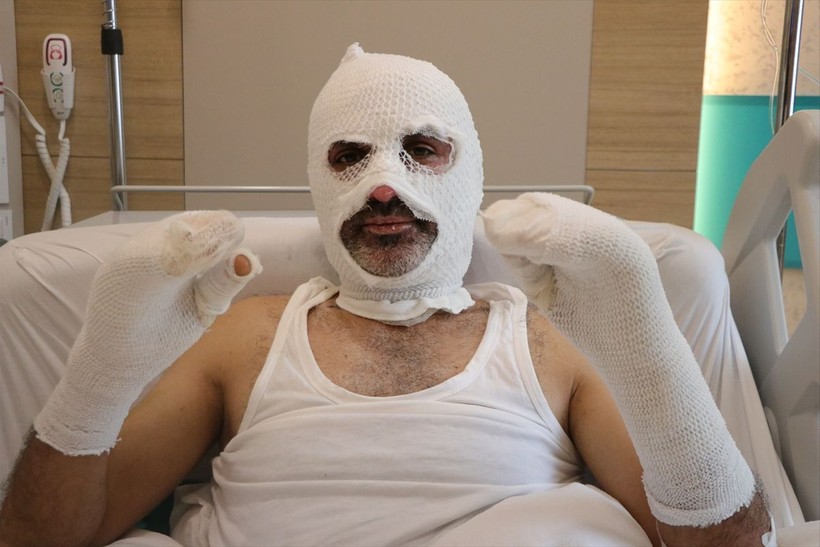 Grip yüzünden ölümden döndü! Ocağı açmasıyla felaketi yaşadı - Resim: 5