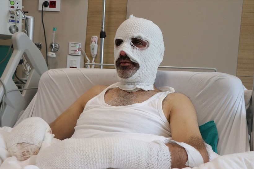 Grip yüzünden ölümden döndü! Ocağı açmasıyla felaketi yaşadı - Resim: 2