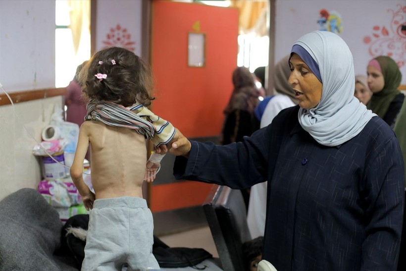 Gazze'de çocuklar açlık nedeniyle ölümle boğuşuyor - Resim: 18