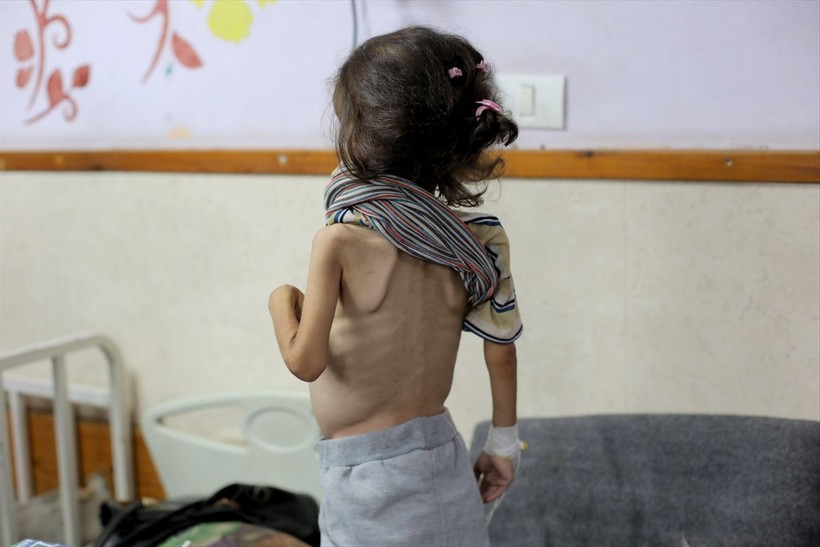 Gazze'de çocuklar açlık nedeniyle ölümle boğuşuyor - Resim: 16