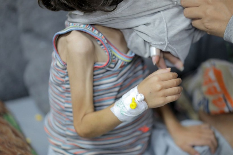 Gazze'de çocuklar açlık nedeniyle ölümle boğuşuyor - Resim: 15