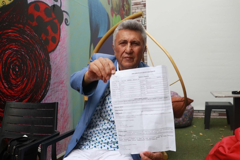 74 yaşındaki hastaya büyük şok! 21 senede 2 kere baypas 27 kere anjiyo oldu: Meğer kalbi... - Resim: 4