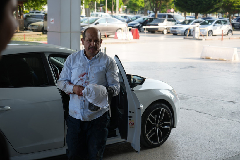 Acemi kasaplar yine sahnede: Bayramın ilk günü hastaneler doldu - Resim : 1