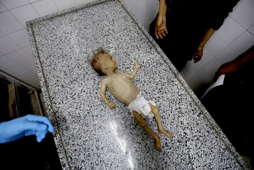 Gazze'de Selam Ebu Vadi açlıktan öldü - Resim: 12
