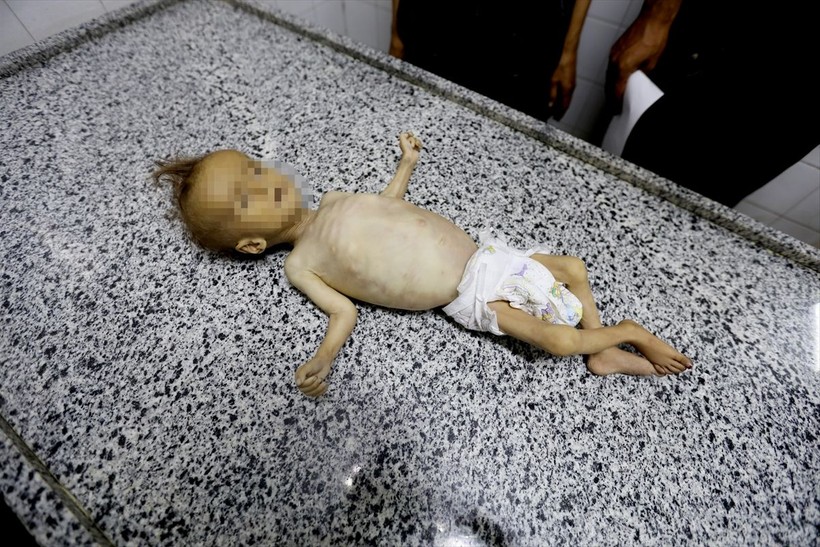 Gazze'de Selam Ebu Vadi açlıktan öldü - Resim: 13