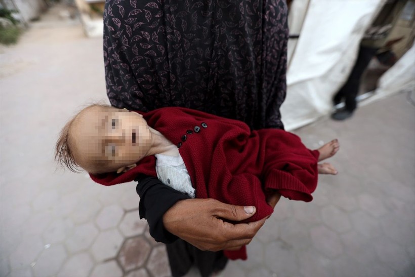 Gazze'de Selam Ebu Vadi açlıktan öldü - Resim: 22