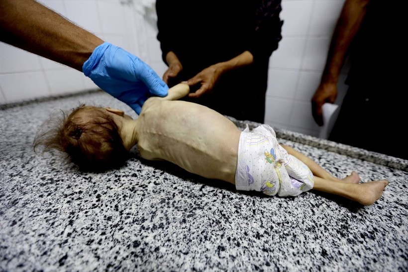 Gazze'de Selam Ebu Vadi açlıktan öldü - Resim: 29