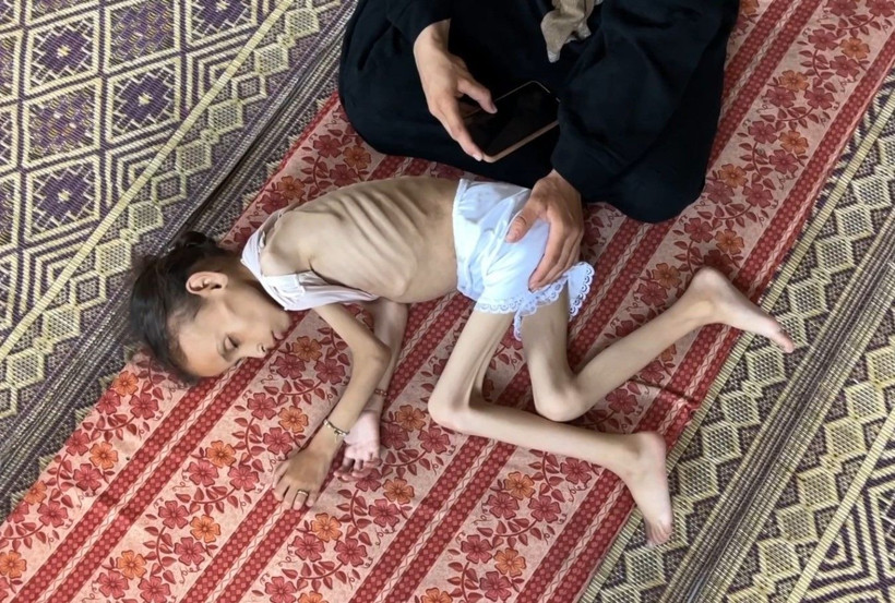 Gazze'de açlıkla mücadele: 9 yaşındaki Meryem 10 kiloya düştü - Resim: 4