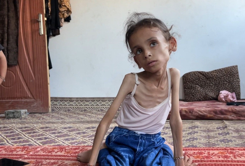 Gazze'de açlıkla mücadele: 9 yaşındaki Meryem 10 kiloya düştü - Resim: 2