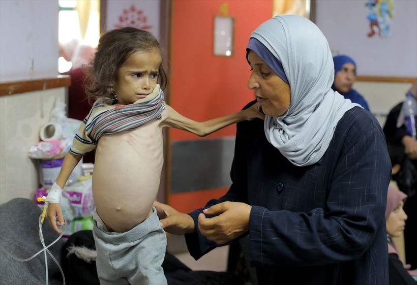 Gazze'de çocuklar açlık nedeniyle ölümle boğuşuyor - Resim: 17