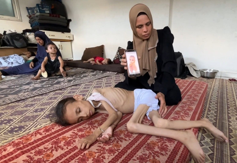 Gazze'de açlıkla mücadele: 9 yaşındaki Meryem 10 kiloya düştü - Resim: 7