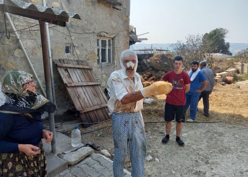 Çanakkale'de alevlerin arasında kaldı ölümden döndü! Dehşet anları anlattı: Yukarıdan ateş yağıyordu - Resim: 21
