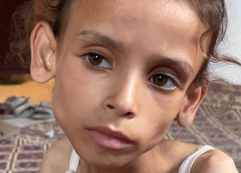 Gazze'de açlıkla mücadele: 9 yaşındaki Meryem 10 kiloya düştü - Resim: 1
