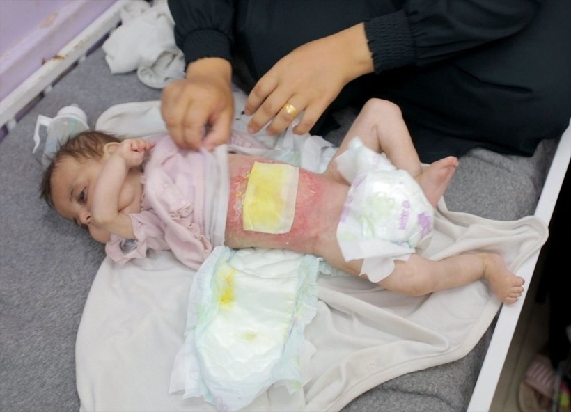 Gazze'de çocuklar açlık nedeniyle ölümle boğuşuyor - Resim: 8
