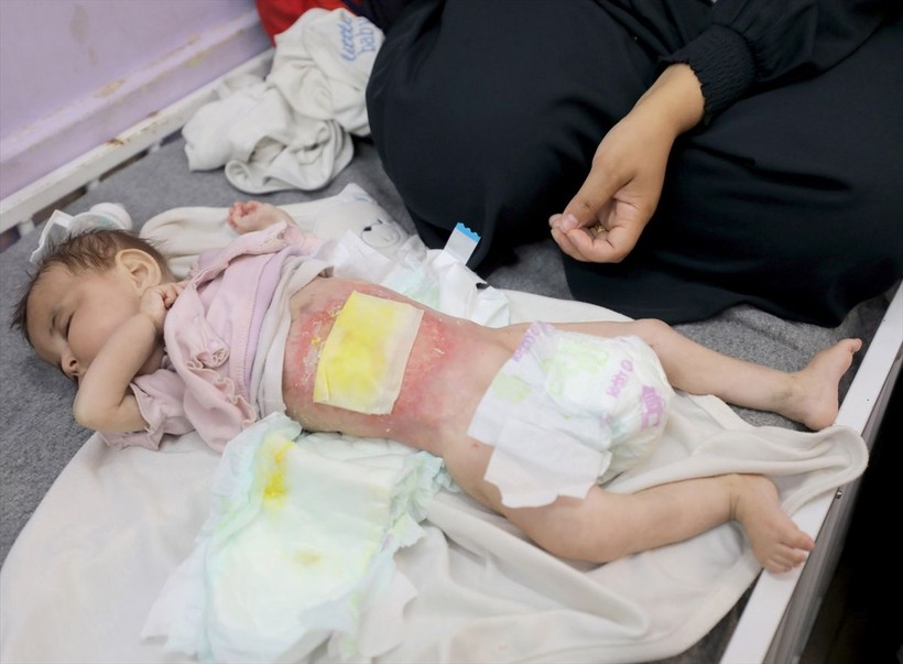 Gazze'de çocuklar açlık nedeniyle ölümle boğuşuyor - Resim: 11