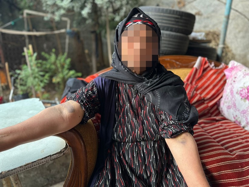 Adana'da tüyler ürperten olay! Baba şikayetini çekmeyince intikamını 8 yaşındaki çocuğundan aldılar - Resim : 4