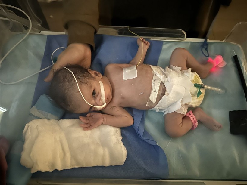 Gazze'deki prematüre bebeklerin canı tehlikede! Elektrik kesintileriyle karşı karşıya - Resim: 1
