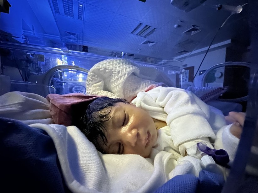 Gazze'deki prematüre bebeklerin canı tehlikede! Elektrik kesintileriyle karşı karşıya - Resim: 12