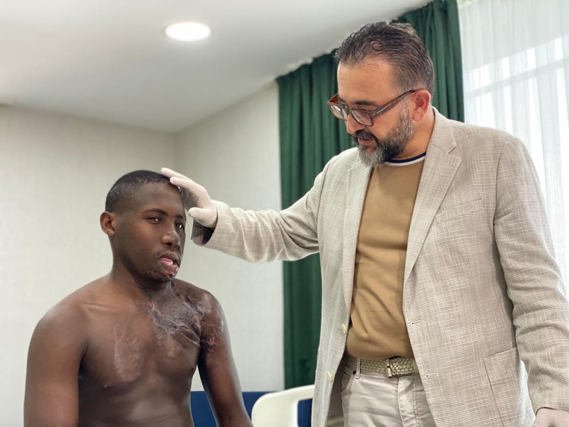 9 yaşındayken feci şekilde yanan Ugandalı çobanın imdadına Türk hekimler koştu - Resim: 6