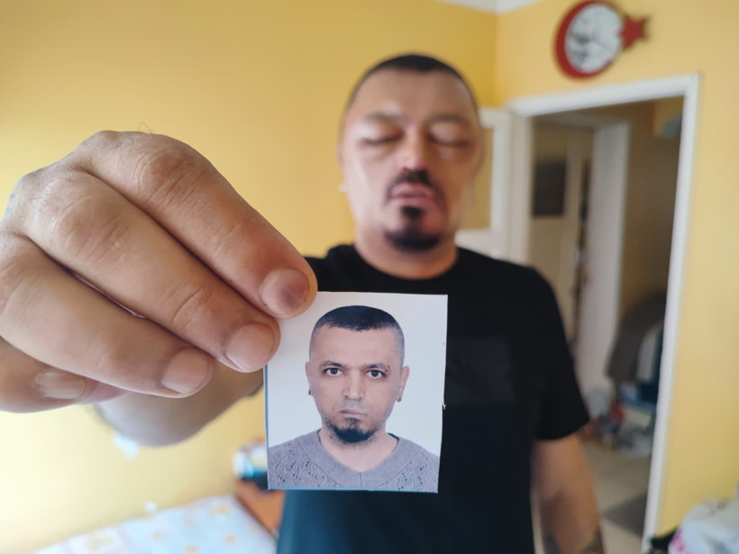 Saçlarını siyahlatmak için aldığı şampuan yüzünden yüzü gözü şişti - Resim : 1