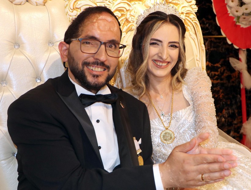 Gerçek aşk dedirten olay: Patlamada sol yanı felç kalan uzman çavuş sevgilisiyle evlendi - Resim: 4