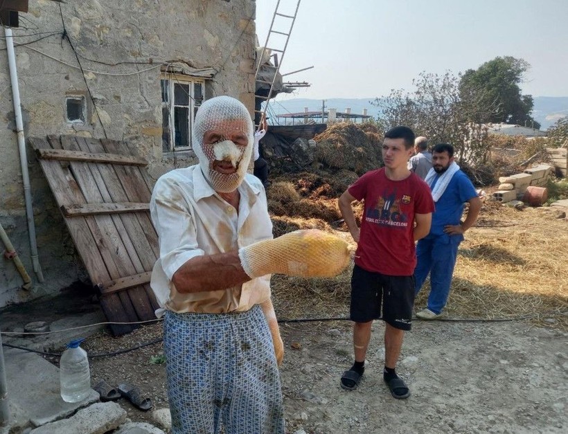 Çanakkale'de alevlerin arasında kaldı ölümden döndü! Dehşet anları anlattı: Yukarıdan ateş yağıyordu - Resim: 20