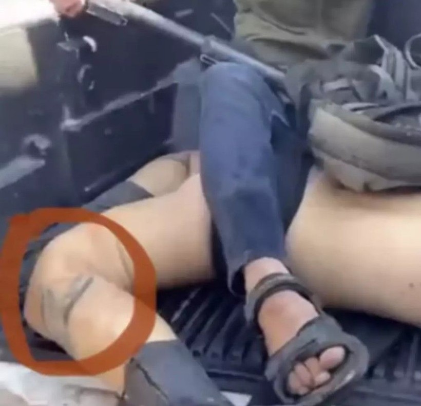 Hamas'ın öldürüp kamyonet kasasında taşıdığı Shani Louk'un bedeni bulundu - Resim: 3