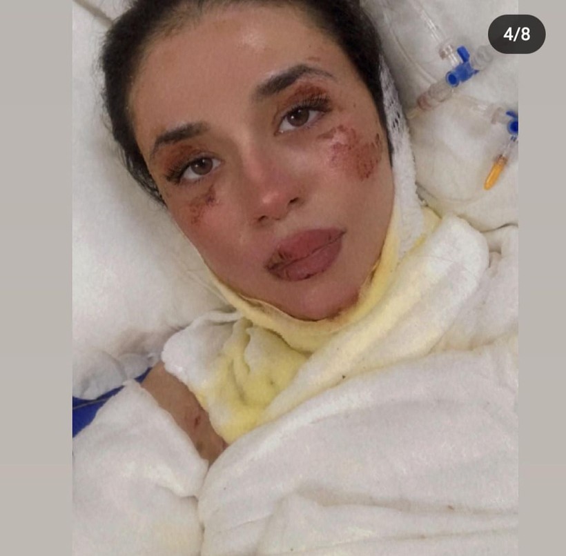 Zonguldak Bülent Ecevit Üniversitesi Hastanesi'nde korkunç olay! Hemşire Önder Erarslan'ın şakası pahalıya mal oldu - Resim: 3