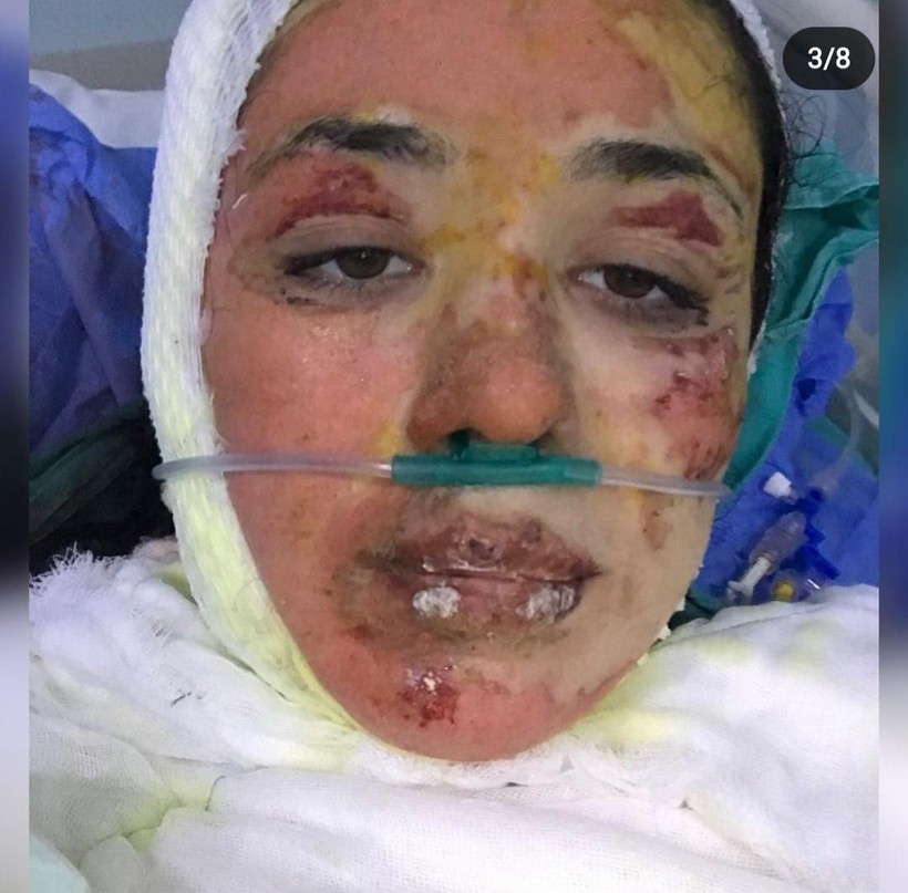 Zonguldak Bülent Ecevit Üniversitesi Hastanesi'nde korkunç olay! Hemşire Önder Erarslan'ın şakası pahalıya mal oldu - Resim: 4