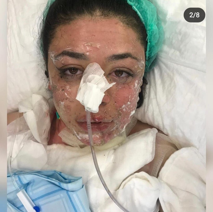 Zonguldak Bülent Ecevit Üniversitesi Hastanesi'nde korkunç olay! Hemşire Önder Erarslan'ın şakası pahalıya mal oldu - Resim: 2