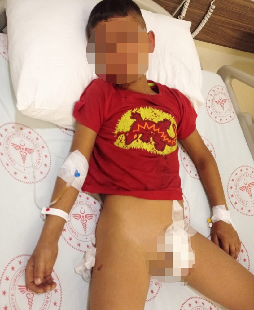 Adana'da tüyler ürperten olay! Baba şikayetini çekmeyince intikamını 8 yaşındaki çocuğundan aldılar - Resim : 2