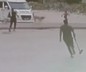 Sokak köpekleri çocuğa saldırdı