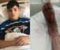 Fabrikada büyük ihmal: Tarlaya giden çocuk az daha ayaklarından oluyordu